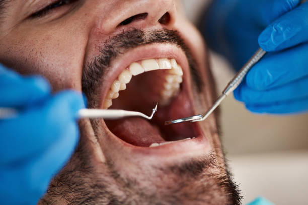 Best Root Canal Treatment  in North Kingsville, OH
